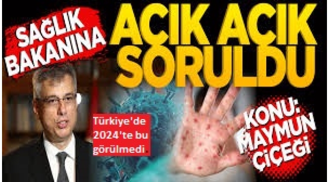 Sağlık Bakanı Memişoğlu'ndan flaş açıklamalar! Maymun Çiçeği virüsü Türkiye'de var mı? Belirtiler neler, nasıl tedbirler almalıyız?.